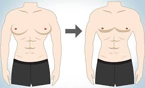Gynecomastia Treatment